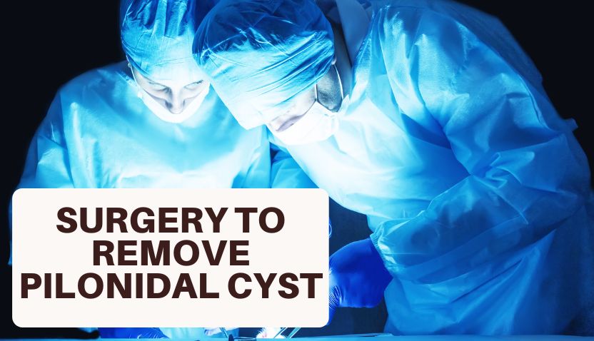 Which Is The Best Surgery To Remove Pilonidal Cyst